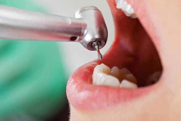 Best Tooth Pain Emergency Relief  in Frisco, TX